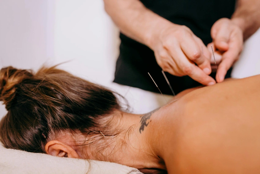 Physiotherapist performing dry needling on a patient's back to relieve muscle pain and trigger points at Attwood Physiotherapy.